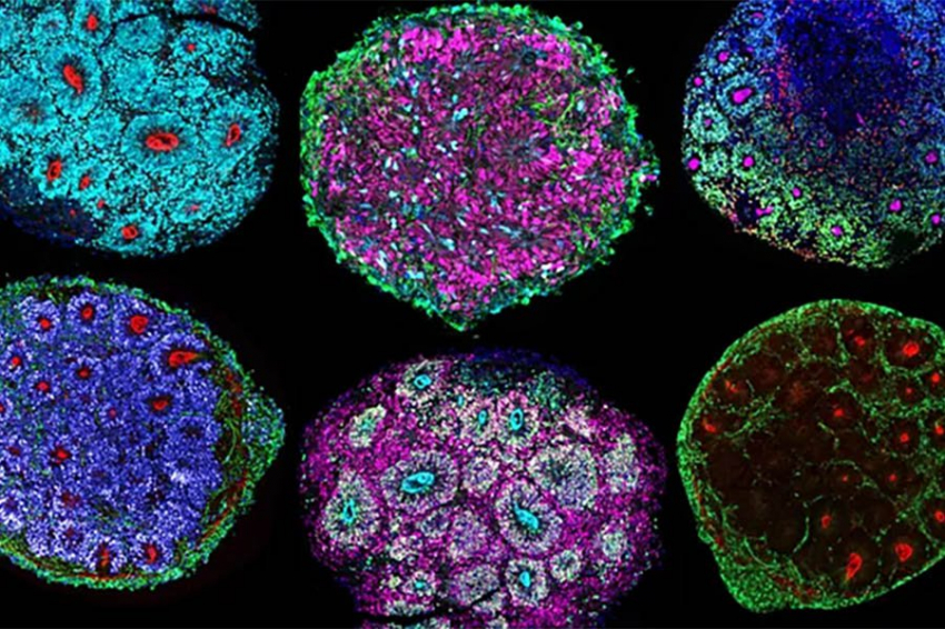 Ученые вырастили первый в истории «мини-мозг» из клеток нескольких людей