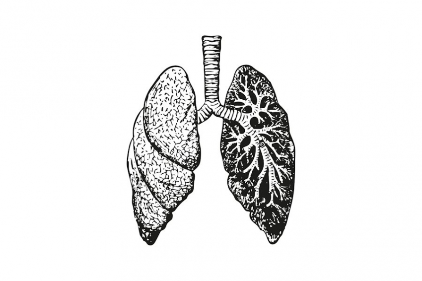 JAMA: приём антипсихотиков повышает риск пневмонии