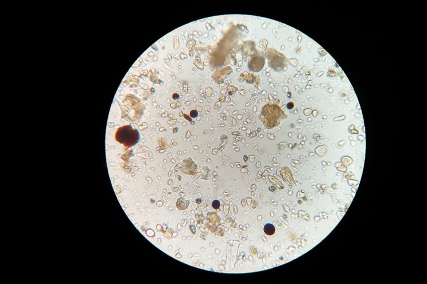 Древние микробы дают представление о том, как развивалась сложная жизнь