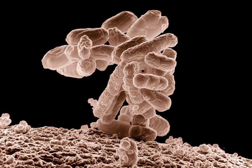 FM: смертельно опасные и устойчивые к радиации микробы живут в микроволновках