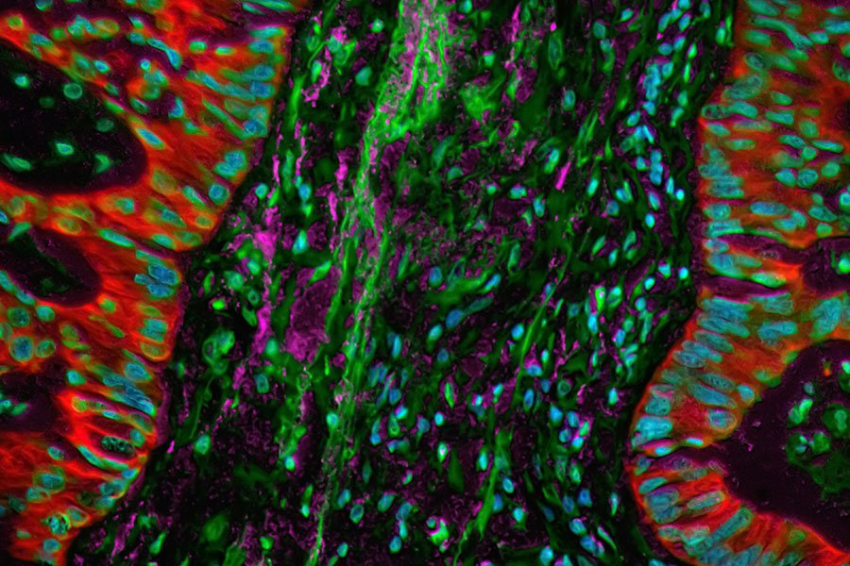 Исследователи объяснили, как гриб Cordyceps militaris борется с раком