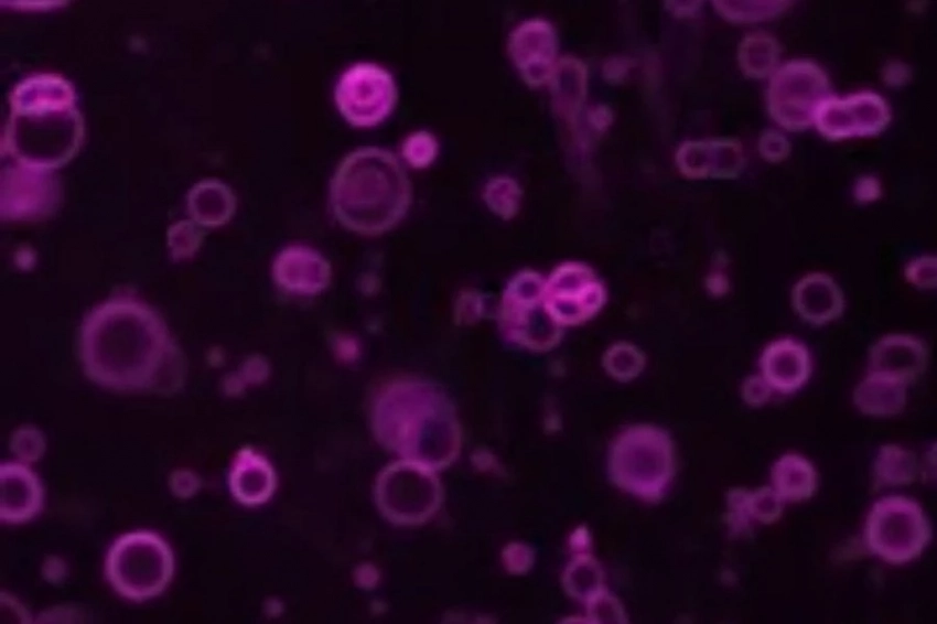 Ученые дали возможное объяснение,  как на Земле появились ранние протоклетки 