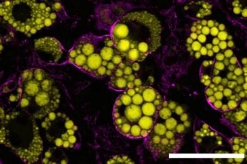 Обнаружен механизм в жировых клетках, защищающий организм от избытка энергии